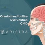 Craniomandibuläre Dysfunktion (CMD) – Ursachen, Diagnose und Behandlung
