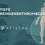 Tiefe Beinvenenthrombose – Symptome und Diagnose